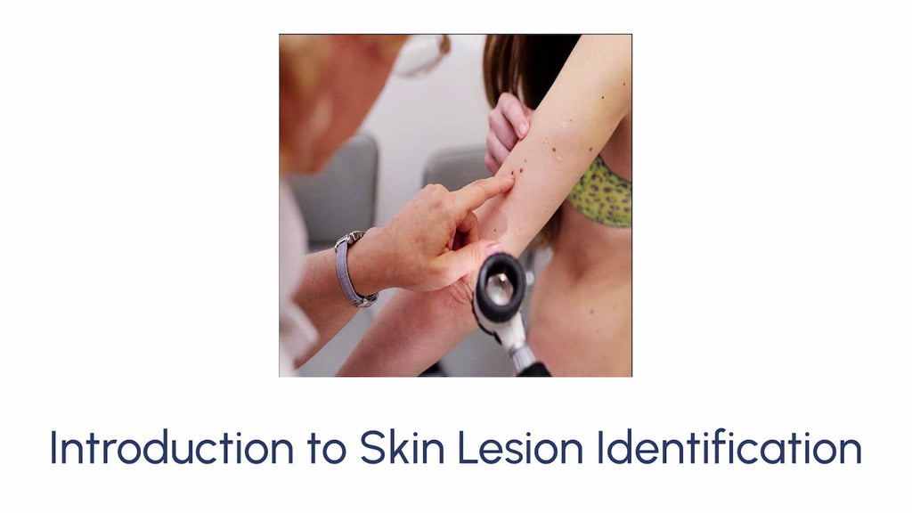 Introduction to Skin Lesion Identification