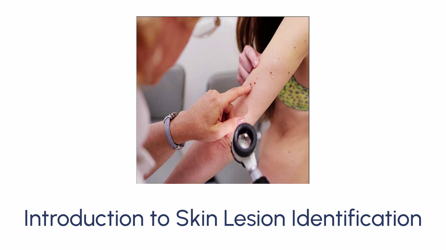 Introduction to Skin Lesion Identification