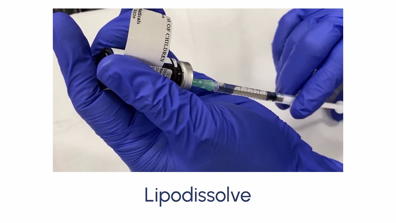 Lipodissolve