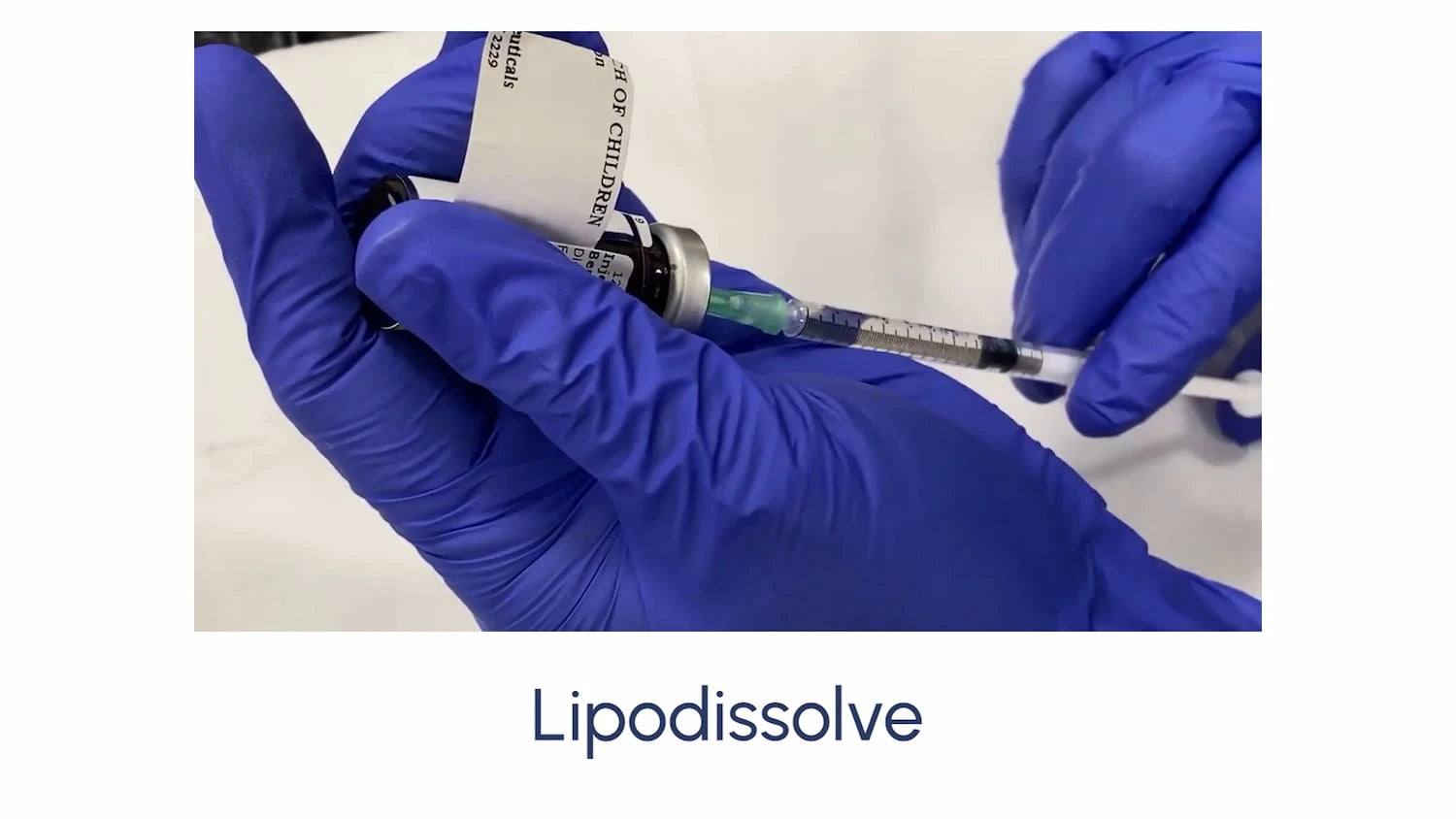 Lipodissolve