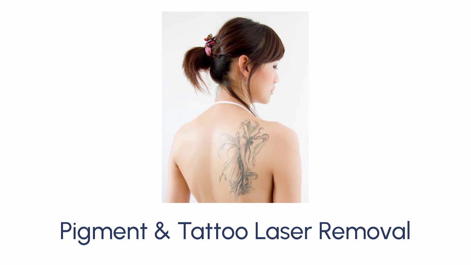 Pigment & Tattoo Laser Removal