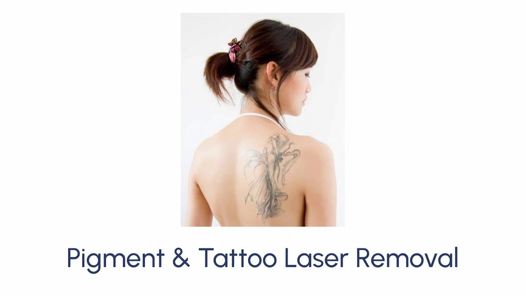 Pigment & Tattoo Laser Removal