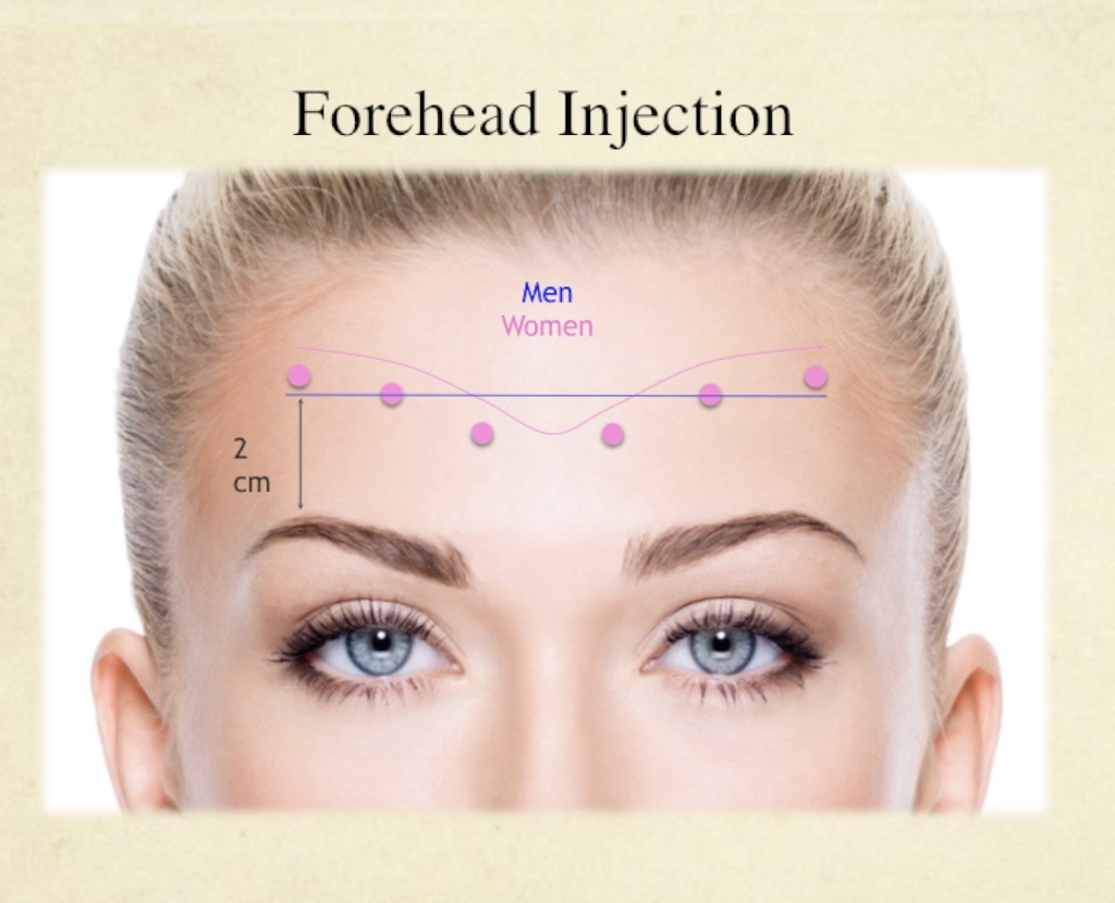 Facial Neuromodulator Injections Course