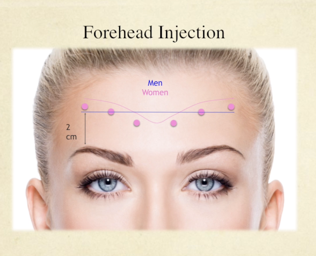 Facial Neuromodulator Injections Course