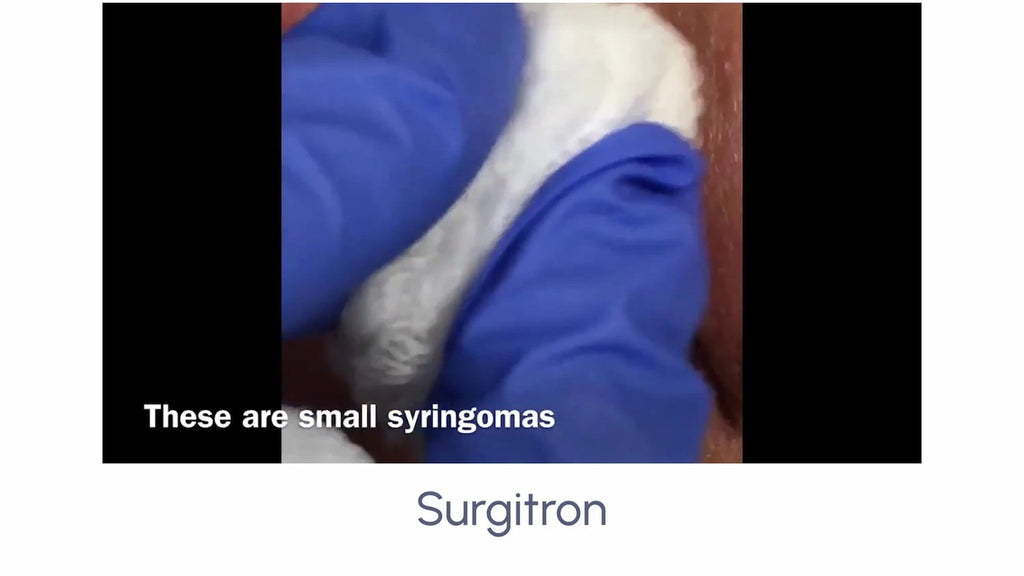 Surgitron