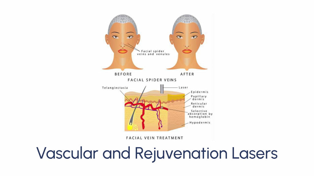 Vascular and Rejuvenation Lasers