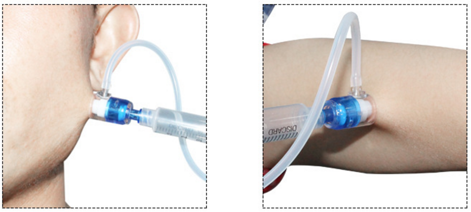 Meso Therapy Injection Pen - Disposable Kits (Pack of 10)