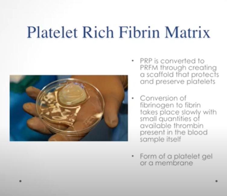 Platelet Rich Plasma (PRP) Platelet Rich Fibrin Matrix (PRFM) in Regenerative Medicine Video Course
