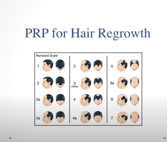 Platelet Rich Plasma (PRP) Platelet Rich Fibrin Matrix (PRFM) in Regenerative Medicine Video Course